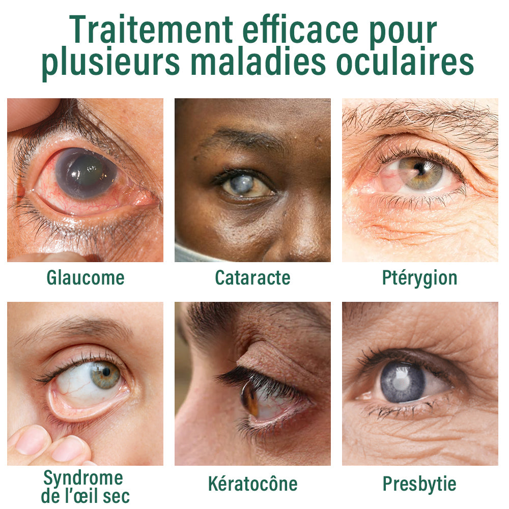 đ©ââïžOurlyardÂź SĂ©rum de Gouttes pour les Yeux Nano â
Convient Ă la presbytie, au syndrome de lâĆil sec, au glaucome et Ă la cataracte đ