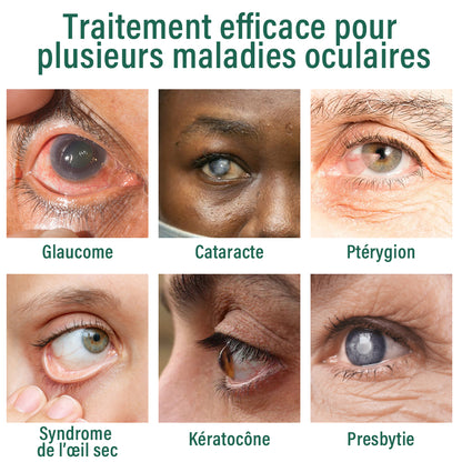 👩‍⚕️Ourlyard® Sérum de Gouttes pour les Yeux Nano ✅Convient à la presbytie, au syndrome de l’œil sec, au glaucome et à la cataracte 👀